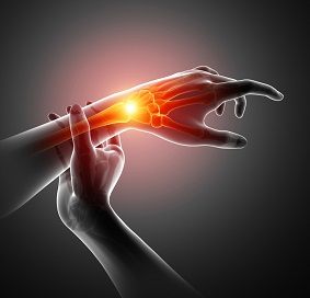 LRTI (Ligament Reconstruction & Tendon Interposition) for Thumb CMC Arthritis