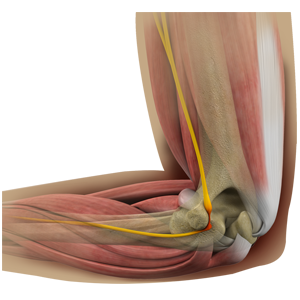 Carpal Tunnel Release