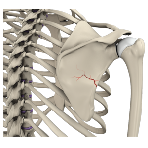 Fracture of the Shoulder Blade (Scapula)
