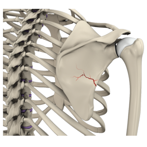 Fracture of the Shoulder Blade