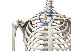 Sternoclavicular Joint Injury