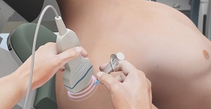 Ultrasound-Guided Shoulder Injections