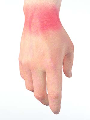 Wrist Pain